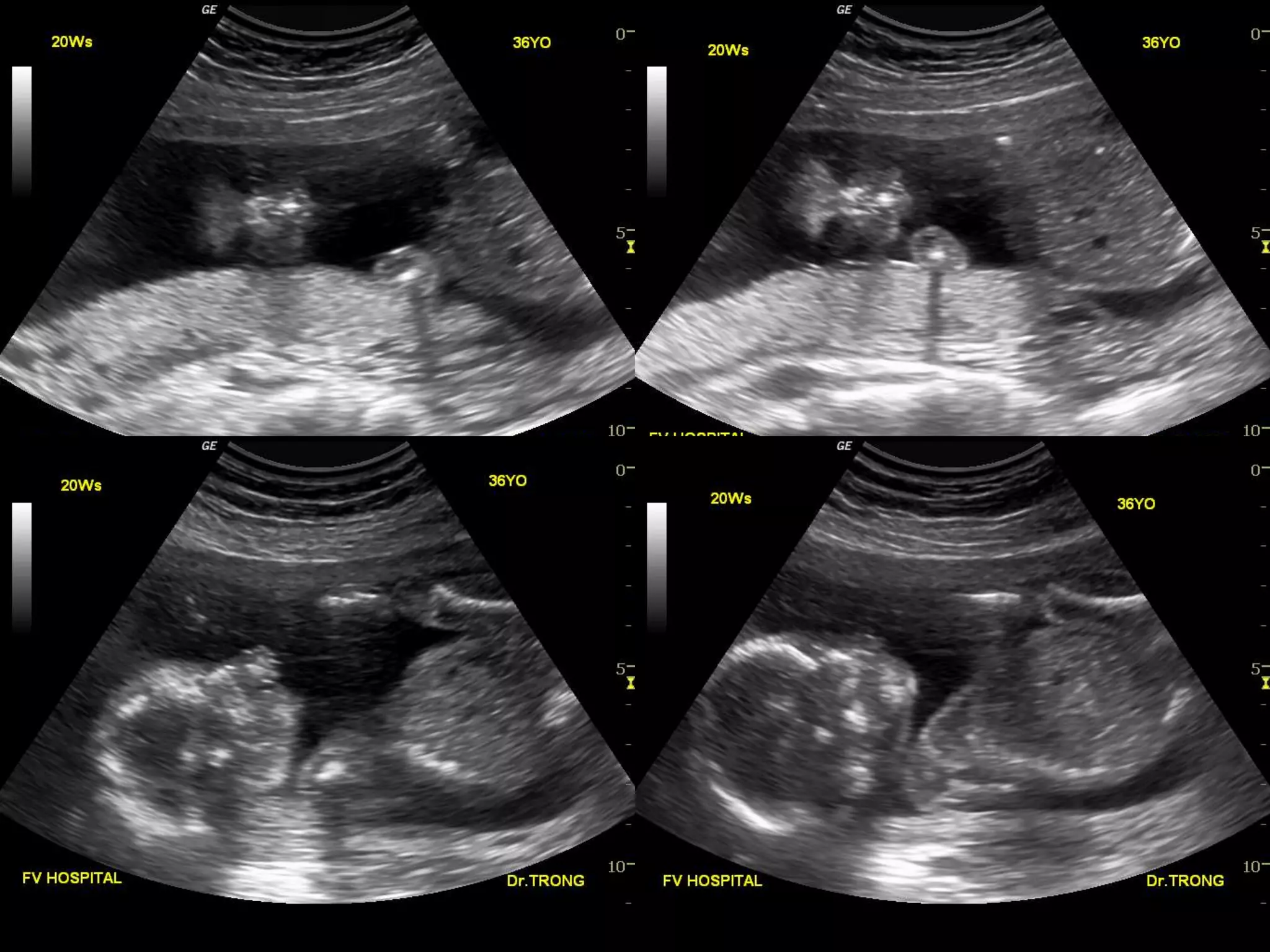 Ormonchining onlayn intim kundaligi