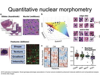 Quantitative nuclear morphometry
2015 Laboratory Investigation. Novel genotype-phenotype associations in human cancers enabled by advanced molecular platforms and computational analysis
of whole slide images
 