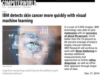 157
In a scan of 3,000 images, IBM
technology was able to spot
melanoma with an accuracy
of about 95 percent, much
better than the 75 percent to
84 percent average of today's
largely manual methods.
IBM Research will continue to
work with Sloan Kettering to
develop additional
measurements and
approaches to further refine
diagnosis, as well as refine
their approach through larger
sets of data.
Dec 17, 2014
 