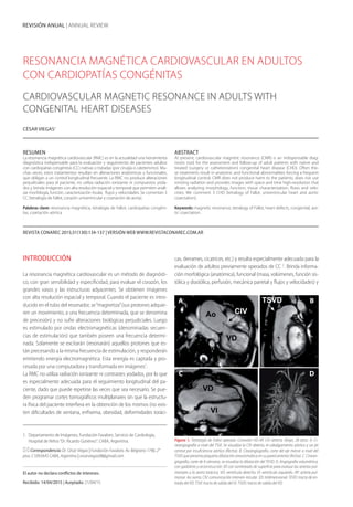 REVISIÓN ANUAL | ANNUAL REVIEW
RESONANCIA MAGNÉTICA CARDIOVASCULAR EN ADULTOS
CON CARDIOPATÍAS CONGÉNITAS
CARDIOVASCULAR MAGNETIC RESONANCE IN ADULTS WITH
CONGENITAL HEART DISEASES
CÉSAR VIEGAS1
RESUMEN
La resonancia magnética cardiovascular (RMC) es en la actualidad una herramienta
diagnóstica indispensable para la evaluación y seguimiento de pacientes adultos
con cardiopatías congénitas (CC) nativas o tratadas (por cirugía o cateterismo). Mu-
chas veces, estos tratamientos resultan en alteraciones anatómicas y funcionales,
que obligan a un control longitudinal frecuente. La RMC no produce alteraciones
perjudiciales para el paciente, no utiliza radiación ionizante ni compuestos yoda-
dos y brinda imágenes con alta resolución espacial y temporal que permiten anali-
zar morfología, función, caracterización tisular, flujos y velocidades. Se comentan 3
CC (tetralogía de Fallot, corazón univentricular y coartación de aorta).
Palabras clave: resonancia magnética, tetralogía de Fallot, cardiopatías congéni-
tas, coartación aórtica
.
ABSTRACT
At present, cardiovascular magnetic resonance (CMR) is an indispensable diag-
nostic tool, for the assessment and follow-up of adult patients with native and
treated (surgery or catheterization) congenital heart disease (CHD). Often the-
se treatments result in anatomic and functional abnormalities forcing a frequent
longitudinal control. CMR does not produce harm to the patients, does not use
ionizing radiation and provides images with space and time high-resolution that
allows analyzing morphology, function, tissue characterization, flows and velo-
cities. We comment 3 CHD (tetralogy of Fallot, univentricular heart and aortic
coarctation).
Keywords: magnetic resonance, tetralogy of Fallot, heart defects, congenital, aor-
tic coarctation.
REVISTA CONAREC 2015;31(130):134-137 | VERSIÓN WEB WWW.REVISTACONAREC.COM.AR
INTRODUCCIÓN
La resonancia magnética cardiovascular es un método de diagnósti-
co, con gran sensibilidad y especificidad, para evaluar el corazón, los
grandes vasos y las estructuras adyacentes. Se obtienen imágenes
con alta resolución espacial y temporal. Cuando el paciente es intro-
ducido en el tubo del resonador, se“magnetiza”(sus protones adquie-
ren un movimiento, a una frecuencia determinada, que se denomina
de precesión) y no sufre alteraciones biológicas perjudiciales. Luego
es estimulado por ondas electromagnéticas (denominadas secuen-
cias de estimulación) que también poseen una frecuencia determi-
nada. Solamente se excitarán (resonarán) aquellos protones que es-
tán precesando a la misma frecuencia de estimulación, y responderán
emitiendo energía electromagnética. Esta energía es captada y pro-
cesada por una computadora y transformada en imágenes1
.
La RMC no utiliza radiación ionizante ni contrastes yodados, por lo que
es especialmente adecuada para el seguimiento longitudinal del pa-
ciente, dado que puede repetirse las veces que sea necesario. Se pue-
den programar cortes tomográficos multiplanares sin que la estructu-
ra física del paciente interfiera en la obtención de los mismos (no exis-
ten dificultades de ventana, enfisema, obesidad, deformidades toráci-
cas, derrames, cicatrices, etc.) y resulta especialmente adecuada para la
evaluación de adultos previamente operados de CC 2
. Brinda informa-
ción morfológica (anatómica), funcional (masa, volúmenes, función sis-
tólica y diastólica, perfusión, mecánica parietal y flujos y velocidades) y
1. Departamento de Imágenes, Fundación Favaloro. Servicio de Cardiología,
Hospital de Niños“Dr. Ricardo Gutiérrez”. CABA, Argentina.
Correspondencia: Dr. César Viegas | Fundación Favaloro. Av. Belgrano 1746, 2°
piso. C1093AAS CABA, Argentina | cesarviegas08@gmail.com
El autor no declara conflictos de intereses.
Recibido: 14/04/2015 | Aceptado: 21/04/15
CIV
VD
Ao
VI
VD
TSVD
Figura 1. Tetralogía de Fallot operada. Conexión VD-AP, CIV abierta. Mujer, 28 años. A. Ci-
neangiografía a nivel del TSVI. Se visualiza la CIV abierta, el cabalgamiento aórtico y un jet
central por insuficiencia aórtica (flecha). B. Cineangiografía, corte del eje menor a nivel del
TSVD que presenta pequeña dilatación aneurismática en su pared anterior (fecha). C. Cinean-
giografía, corte de 4 cámaras, se visualiza la dilatación del TEVD. D. Angiografía volumétrica,
con gadolinio y reconstrucción 3D con sombreado de superficie para evaluar las arterias pul-
monares y la aorta torácica. VD: ventrículo derecho. VI: ventrículo izquierdo. AP: arteria pul-
monar. Ao: aorta. CIV: comunicación interven-tricular. 3D: tridimensional. TEVD: tracto de en-
trada del VD. TSVI: tracto de salida del VI. TSVD: tracto de salida del VD.
A
C
B
D
 