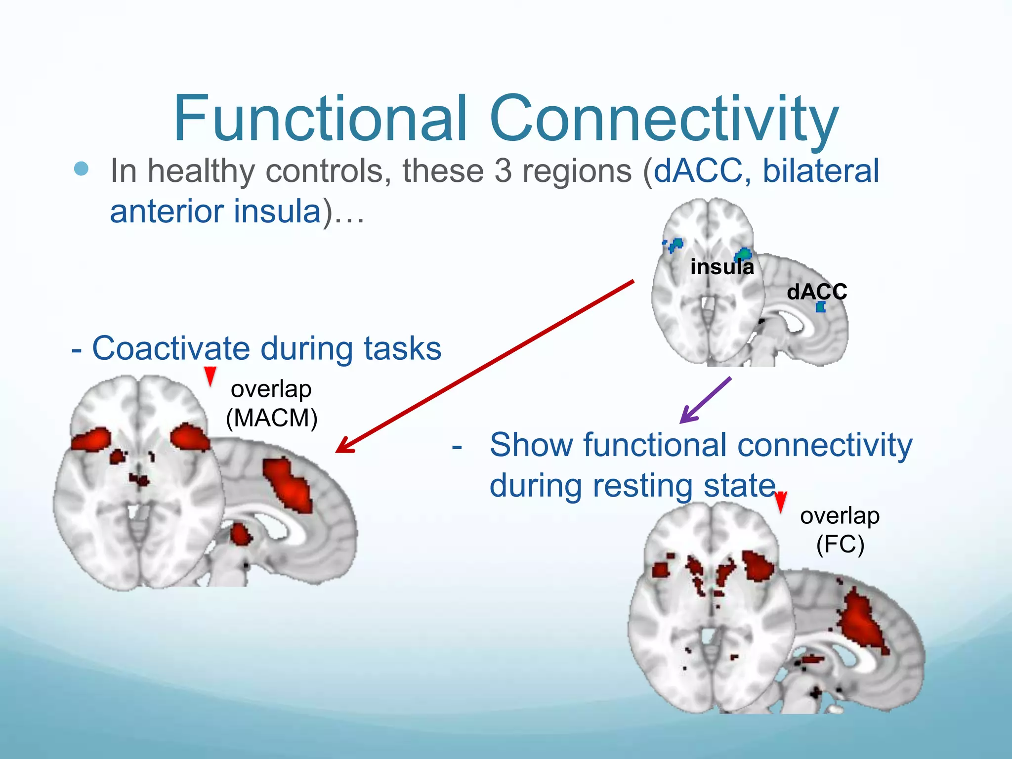 Functional Connectivity
 In healthy controls, these 3 regions (dACC, bilateral
anterior insula)…
- Coactivate during tasks
dACC
insula
cingulate
R insulaL insula
overlap
(MACM)
cingulate
R insulaL insula
overlap
(FC)
- Show functional connectivity
during resting state
 