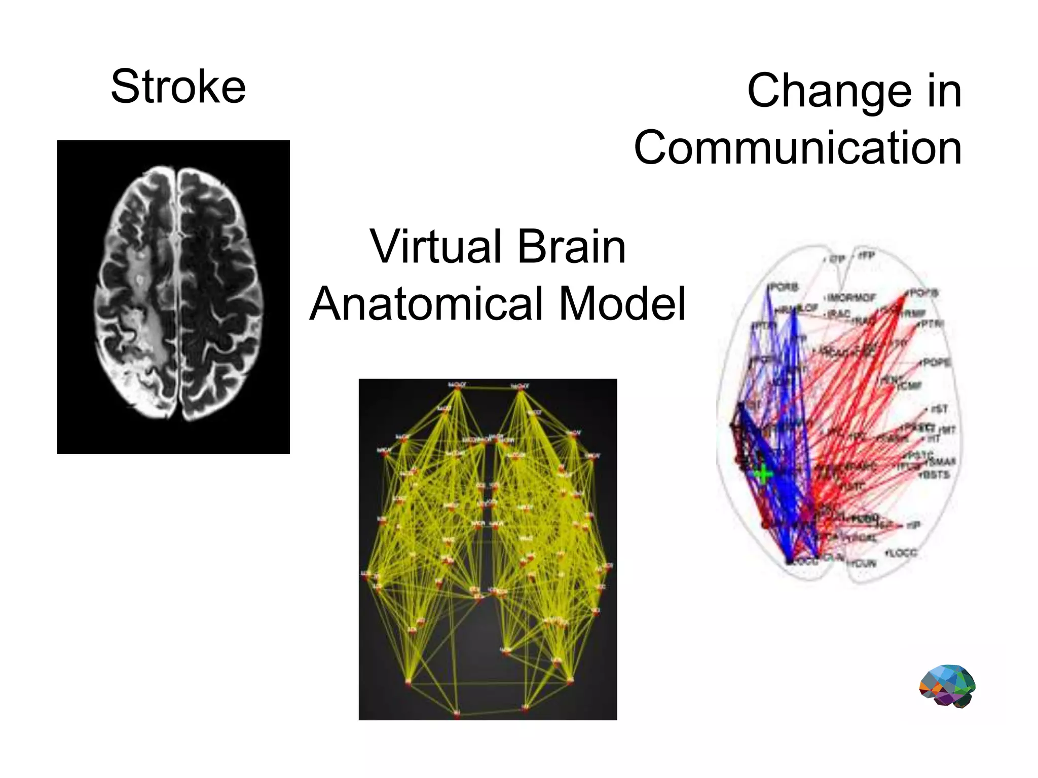 Stroke
Virtual Brain
Anatomical Model
Change in
Communication
 