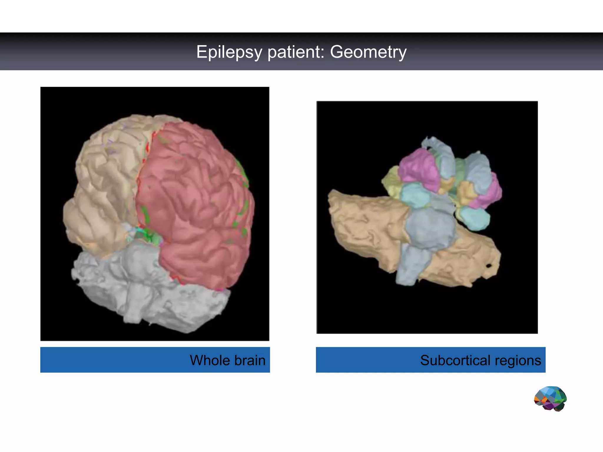 Whole brain Subcortical regions
Epilepsy patient: Geometry
 