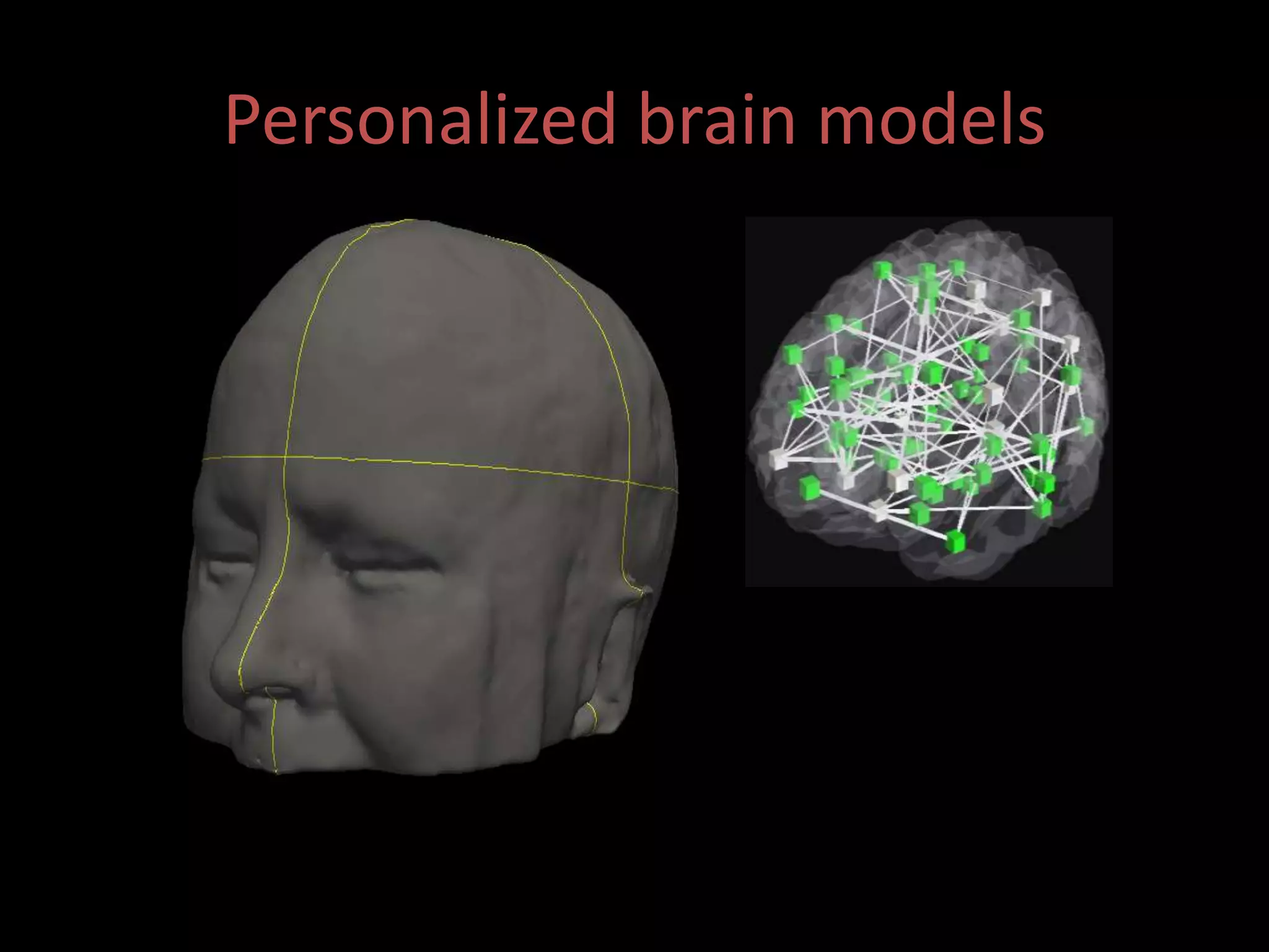 26
Personalized brain models
 