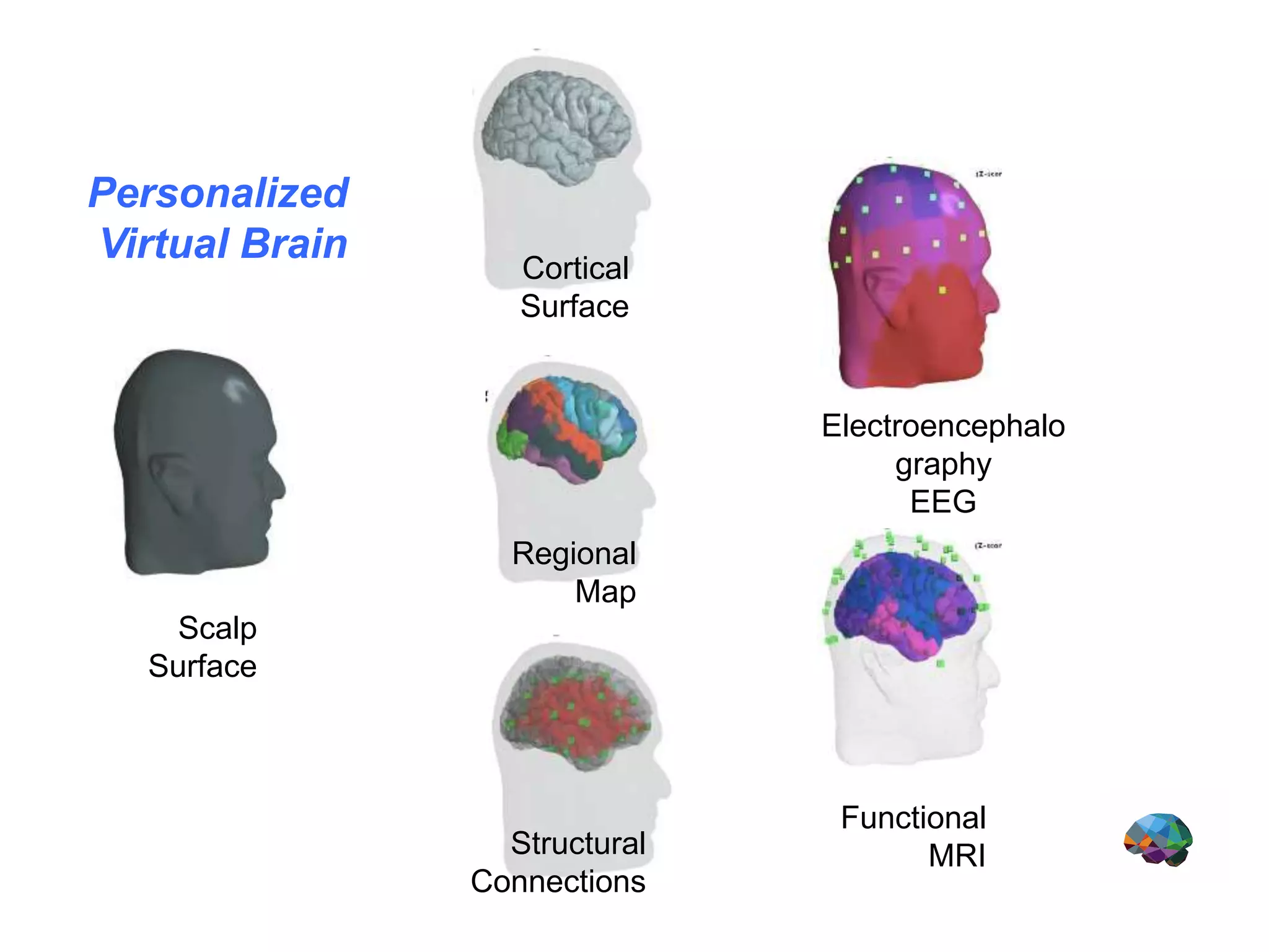Scalp
Surface
Regional
Map
Cortical
Surface
Electroencephalo
graphy
EEG
Functional
MRIStructural
Connections
Personalized
Virtual Brain
 