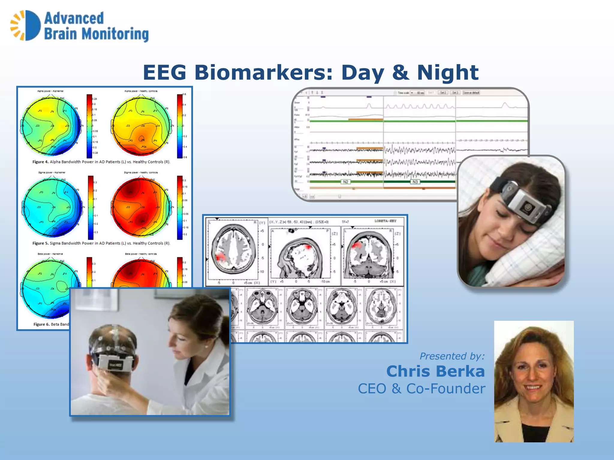 Presented by:
Chris Berka
CEO & Co-Founder
EEG Biomarkers: Day & Night
 