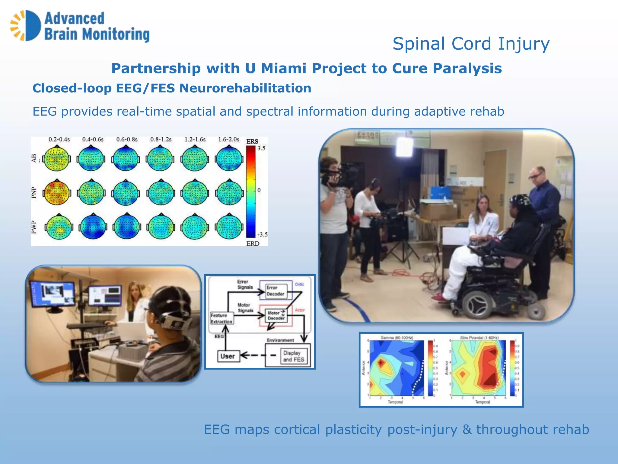 Closed-loop EEG/FES Neurorehabilitation
EEG provides real-time spatial and spectral information during adaptive rehab
Partnership with U Miami Project to Cure Paralysis
EEG maps cortical plasticity post-injury & throughout rehab
Spinal Cord Injury
 