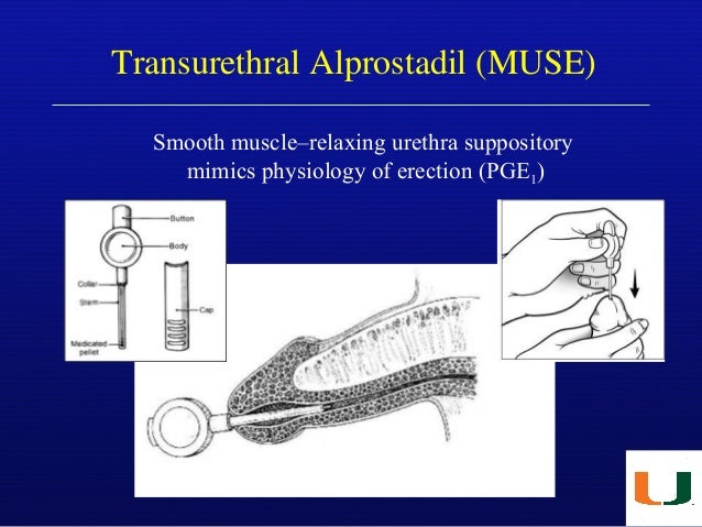 alprostadil urethral suppository in india