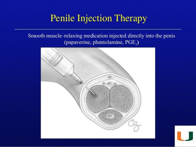 What are some tips for a successful self-penile Trimix injection?