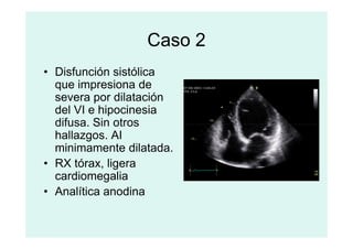 Caso 2
• Disfunción sistólica
que impresiona de
severa por dilatación
del VI e hipocinesia
difusa. Sin otros
difusa. Sin otros
hallazgos. AI
minimamente dilatada.
• RX tórax, ligera
cardiomegalia
• Analítica anodina
 