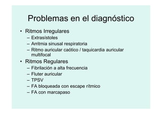 Problemas en el diagnóstico
• Ritmos Irregulares
– Extrasístoles
– Arritmia sinusal respiratoria
– Ritmo auricular caótico / taquicardia auricular
multifocal
multifocal
• Ritmos Regulares
– Fibrilación a alta frecuencia
– Fluter auricular
– TPSV
– FA bloqueada con escape rítmico
– FA con marcapaso
 