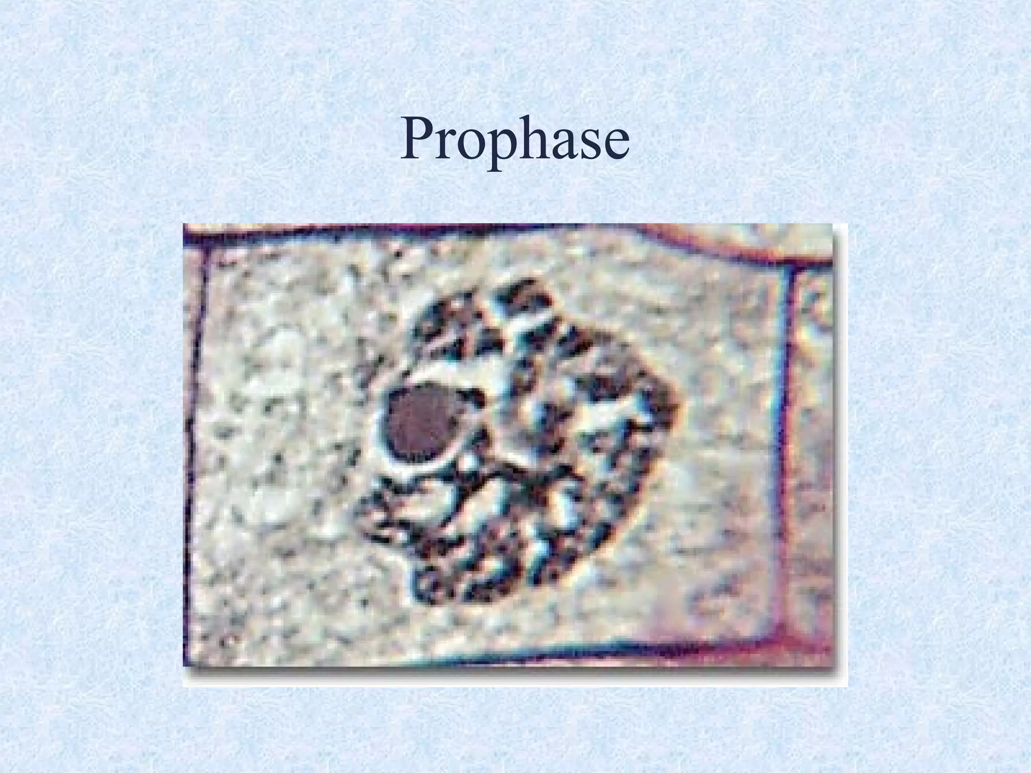 Prophase
 