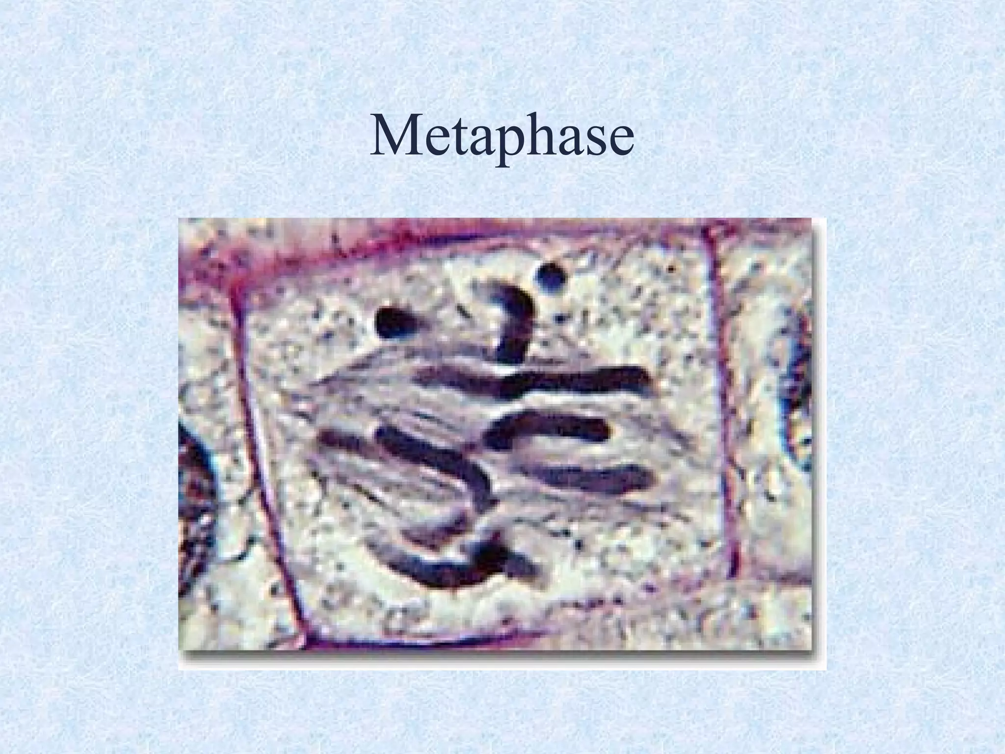 Metaphase
 