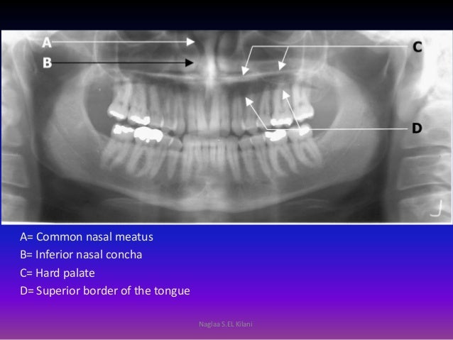 2015 radiology revision