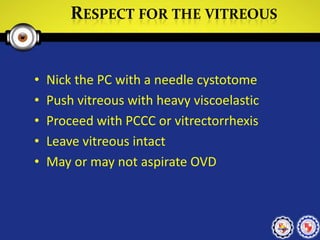 RESPECT FOR THE VITREOUS
• Nick the PC with a needle cystotome
• Push vitreous with heavy viscoelastic
• Proceed with PCCC or vitrectorrhexis
• Leave vitreous intact
• May or may not aspirate OVD
 