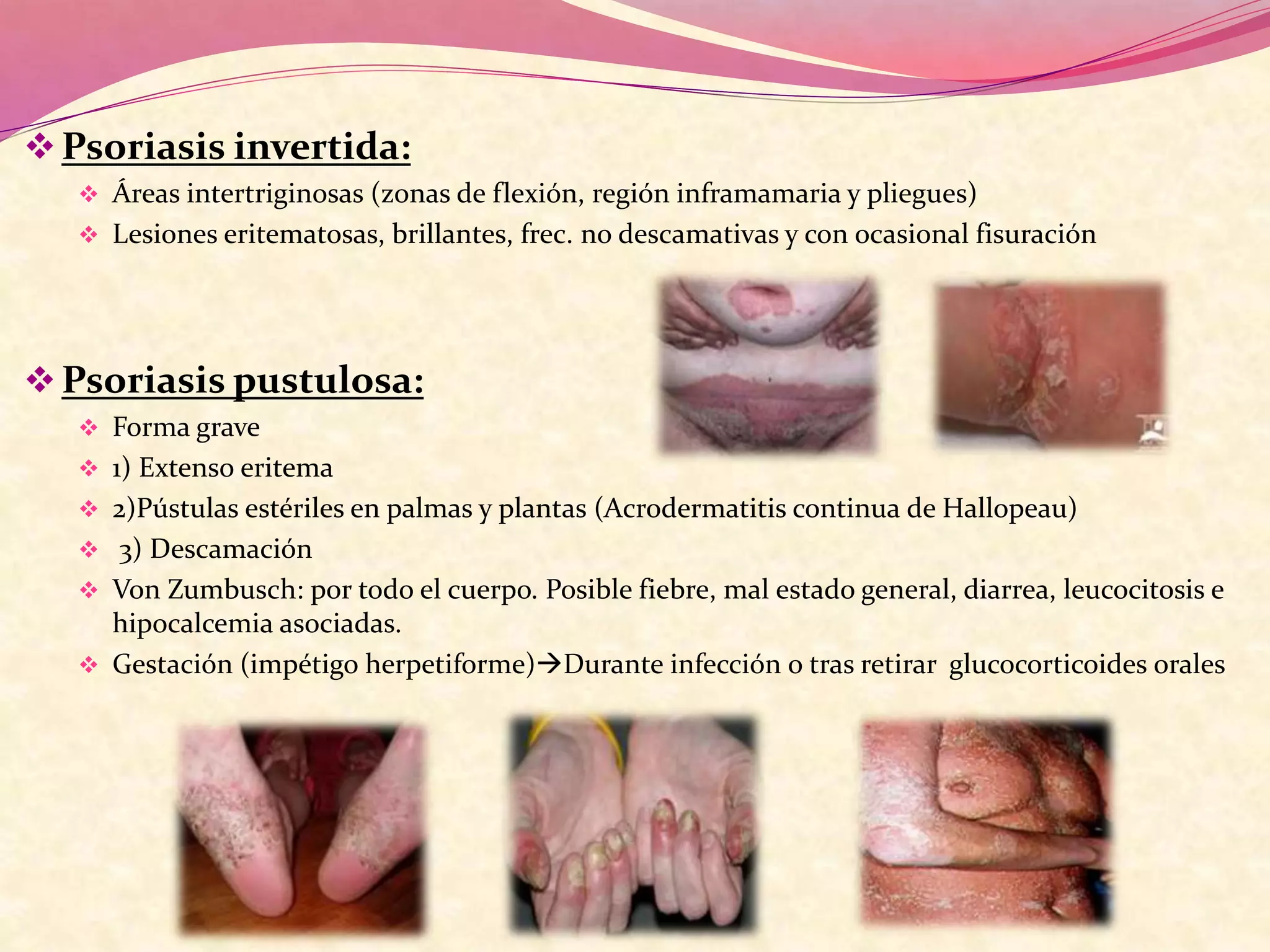 Psoriasis invertida:
 Áreas intertriginosas (zonas de flexión, región inframamaria y pliegues)
 Lesiones eritematosas, brillantes, frec. no descamativas y con ocasional fisuración
Psoriasis pustulosa:
 Forma grave
 1) Extenso eritema
 2)Pústulas estériles en palmas y plantas (Acrodermatitis continua de Hallopeau)
 3) Descamación
 Von Zumbusch: por todo el cuerpo. Posible fiebre, mal estado general, diarrea, leucocitosis e
hipocalcemia asociadas.
 Gestación (impétigo herpetiforme)Durante infección o tras retirar glucocorticoides orales
 