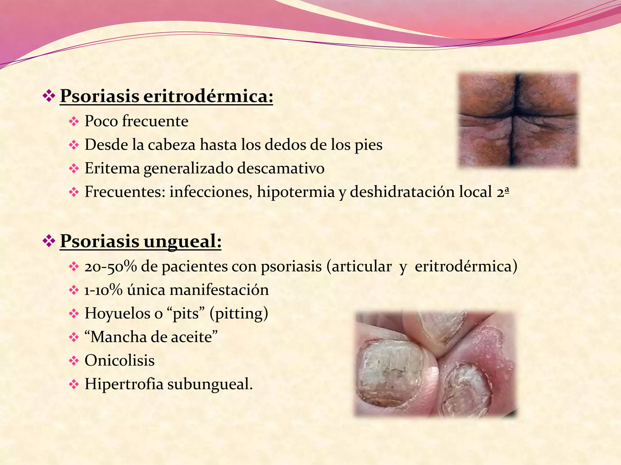 Psoriasis eritrodérmica:
 Poco frecuente
 Desde la cabeza hasta los dedos de los pies
 Eritema generalizado descamativo
 Frecuentes: infecciones, hipotermia y deshidratación local 2ª
Psoriasis ungueal:
 20-50% de pacientes con psoriasis (articular y eritrodérmica)
 1-10% única manifestación
 Hoyuelos o “pits” (pitting)
 “Mancha de aceite”
 Onicolisis
 Hipertrofia subungueal.
 