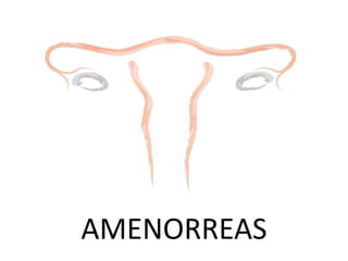 AMENORREAS
 