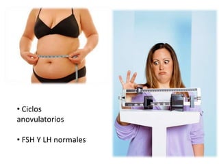 • Ciclos
anovulatorios
• FSH Y LH normales
 