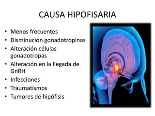 CAUSA HIPOFISARIA
• Menos frecuentes
• Disminución gonadotropinas
• Alteración células
gonadotropas
• Alteración en la llegada de
GnRH
• Infecciones
• Traumatismos
• Tumores de hipófisis
 