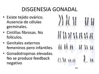 DISGENESIA GONADAL
• Existe tejido ovárico.
Ausencia de células
germinales.
• Cintillas fibrosas. No
folículos.
• Genitales externos
femeninos pero infantiles.
• Gonadotropinas elevadas.
No se produce feedback
negativo
 