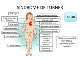 SÍNDROME DE TURNER
45 X0
Niveles de estradiol
muy bajos y
gonadotropinas
elevadas.
 