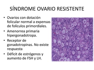 SÍNDROME OVARIO RESISTENTE
• Ovarios con dotación
folicular normal a expensas
de folículos primordiales.
• Amenorrea primaria
hipergonadotropa.
• Receptor de
gonadotropinas. No existe
respuesta
• Déficit de estrógenos y
aumento de FSH y LH.
 
