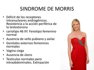 SINDROME DE MORRIS
• Déficit de los receptores
intranucleares androgénicos.
Resistencia a la acción periférica de
la testosterona
• cariotipo 46 XY. Fenotipo femenino
normal
• Ausencia de vello pubiano y axilar.
• Genitales externos femeninos
normales
• Vagina ciega
• Ausencia de útero
• Testículos normales pero
intraabdominales. Extirpación
 