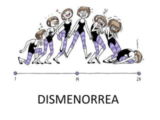 DISMENORREA
 