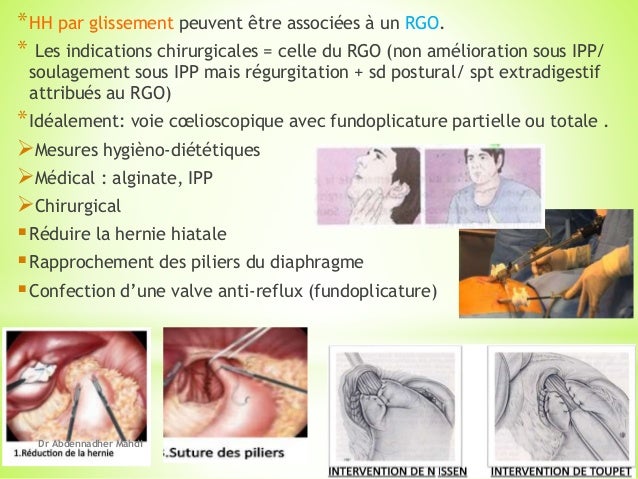 Le traitement korechkovogo du syndrome du service lombaire le traitement