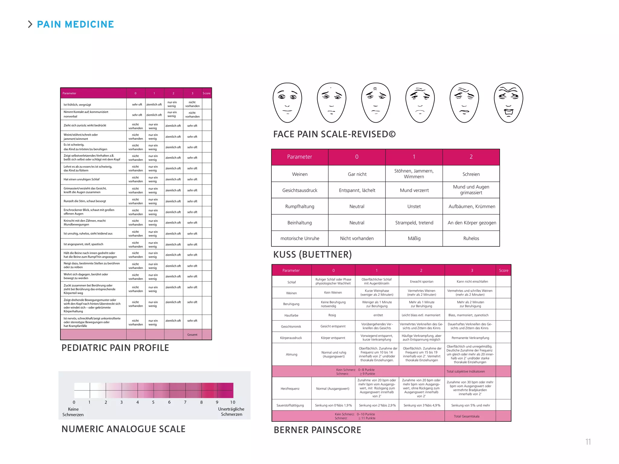 PAIN MEDICINE
11
PEDIATRIC PAIN PROFILE
FACE PAIN SCALE-REVISED©
Parameter 0 1 2
Weinen
Gesichtsausdruck
Rumpfhaltung
Beinhaltung
motorische Unruhe
Gar nicht
Entspannt, lächelt
Neutral
Neutral
Nicht vorhanden
Stöhnen, Jammern,
Wimmern
Mund verzerrt
Unstet
Strampeld, tretend
Mäßig
Schreien
Mund und Augen
grimassiert
Aufbäumen, Krümmen
An den Körper gezogen
Ruhelos
KUSS (BUETTNER)
BERNER PAINSCORE
Oberflächlich und unregelmäßig.
Deutliche Zunahme der Frequenz
um gleich oder mehr als 20 inner-
halb von 2’ und/oder starke
thorakale Einziehungen
Oberflächlich. Zunahme der
Frequenz um 15 bis 19
innerhalb von 2’. Vermehrt
thorakale Einziehungen
Oberflächlich. Zunahme der
Frequenz um 10 bis 14
innerhalb von 2’ und/oder
thorakale Einziehungen.
Normal und ruhig
(Ausgangswert)
Atmung
Körperausdruck
Gesichtsmimik
Hautfarbe
Beruhigung
Weinen
Schlaf
Parameter 2 310 Score
Zunahme von 20 bpm oder
mehr bpm vom Ausgangs-
wert, ohne Rückgang zum
Ausgangswert innerhalb
von 2’
Zunahme von 30 bpm oder mehr
bpm vom Ausgangswert oder
vermehrte Bradykardien
innerhalb von 2’
Zunahme von 20 bpm oder
mehr bpm vom Ausgangs-
wert, mit Rückgang zum
Ausgangswert innerhalb
von 2’
Normal (Ausgangswert)Herzfrequenz
Sauerstoffsättigung Senkung von 0%bis 1,9% Senkung von 2%bis 2,9% Senkung von 3%bis 4,9% Senkung von 5% und mehr
Kein Schmerz: 0–10 Punkte
Schmerz: ≥ 11 Punkte
Total Gesamtskala
Kein Schmerz: 0–8 Punkte
Schmerz: ≥ 9 Punkte
Total subjektive Indikatoren
Ruhiger Schlaf oder Phase
physiologischer Wachheit
Oberflächlicher Schlaf
mit Augenblinzeln
Erwacht spontan Kann nicht einschlafen
Kurze Weinphase
(weniger als 2 Minuten)
Vermehrtes Weinen
(mehr als 2 Minuten)
Vermehrtes und schrilles Weinen
(mehr als 2 Minuten)
Kein Weinen
Keine Beruhigung
notwendig
Weniger als 1 Minute
zur Beruhigung
Mehr als 1 Minute
zur Beruhigung
Mehr als 2 Minuten
zur Beruhigung
Rosig errötet Leicht blass evtl. marmoriert Blass, marmoriert, zyanotisch
Gesicht entspannt
Vorübergehendes Ver-
kneifen des Gesichts
Vermehrtes Verkneifen des Ge-
sichts und Zittern des Kinns
Dauerhaftes Verkneifen des Ge-
sichts und Zittern des Kinns
Körper entspannt Permanente Verkrampfung
Vorwiegend entspannt,
kurze Verkrampfung
Häufige Verkrampfung, aber
auch Entspannung möglich
NUMERIC ANALOGUE SCALE
 