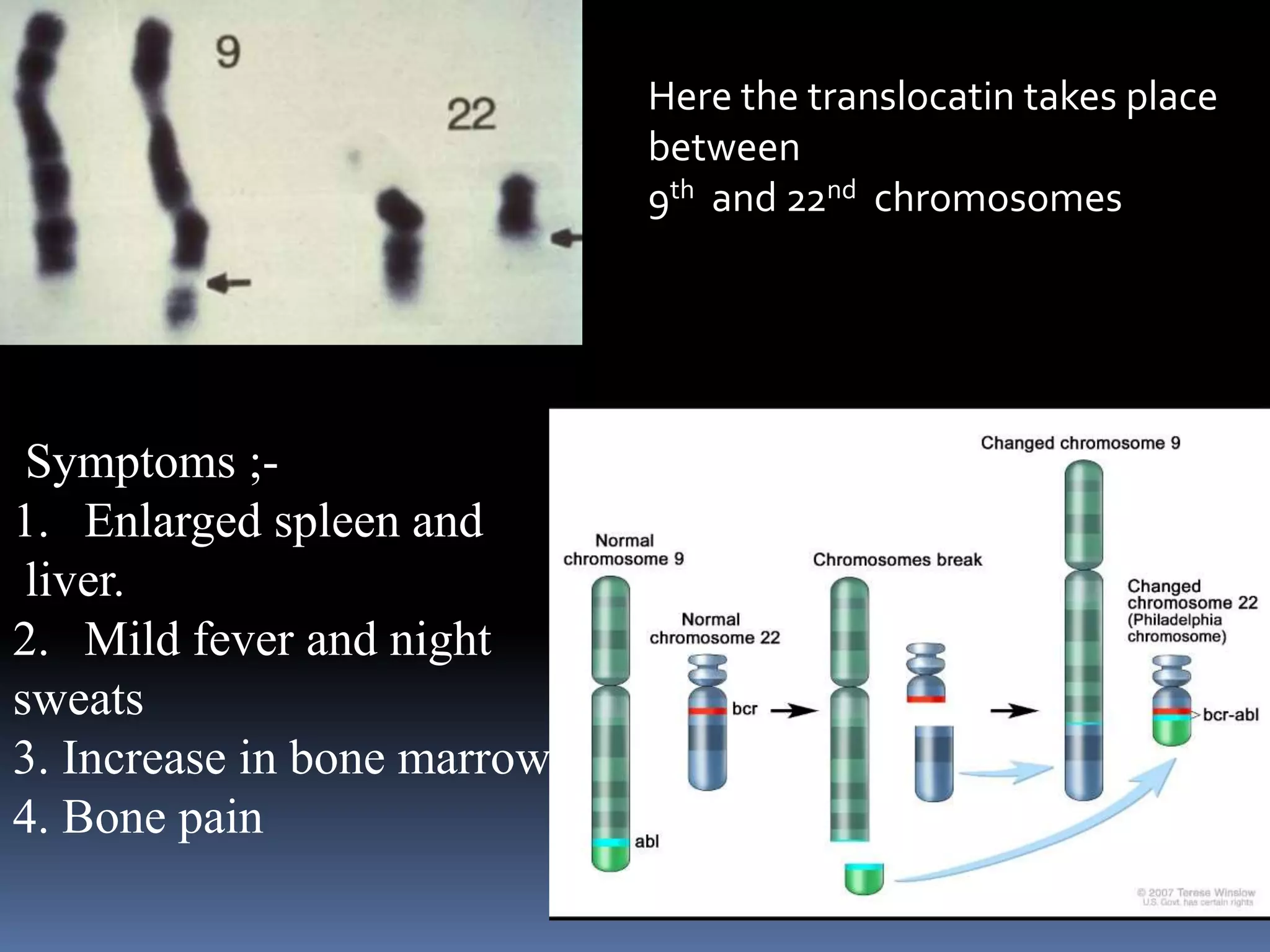 Here the translocatin takes place
between
9th and 22nd chromosomes
Symptoms ;-
1. Enlarged spleen and
liver.
2. Mild fever and night
sweats
3. Increase in bone marrow
4. Bone pain
 
