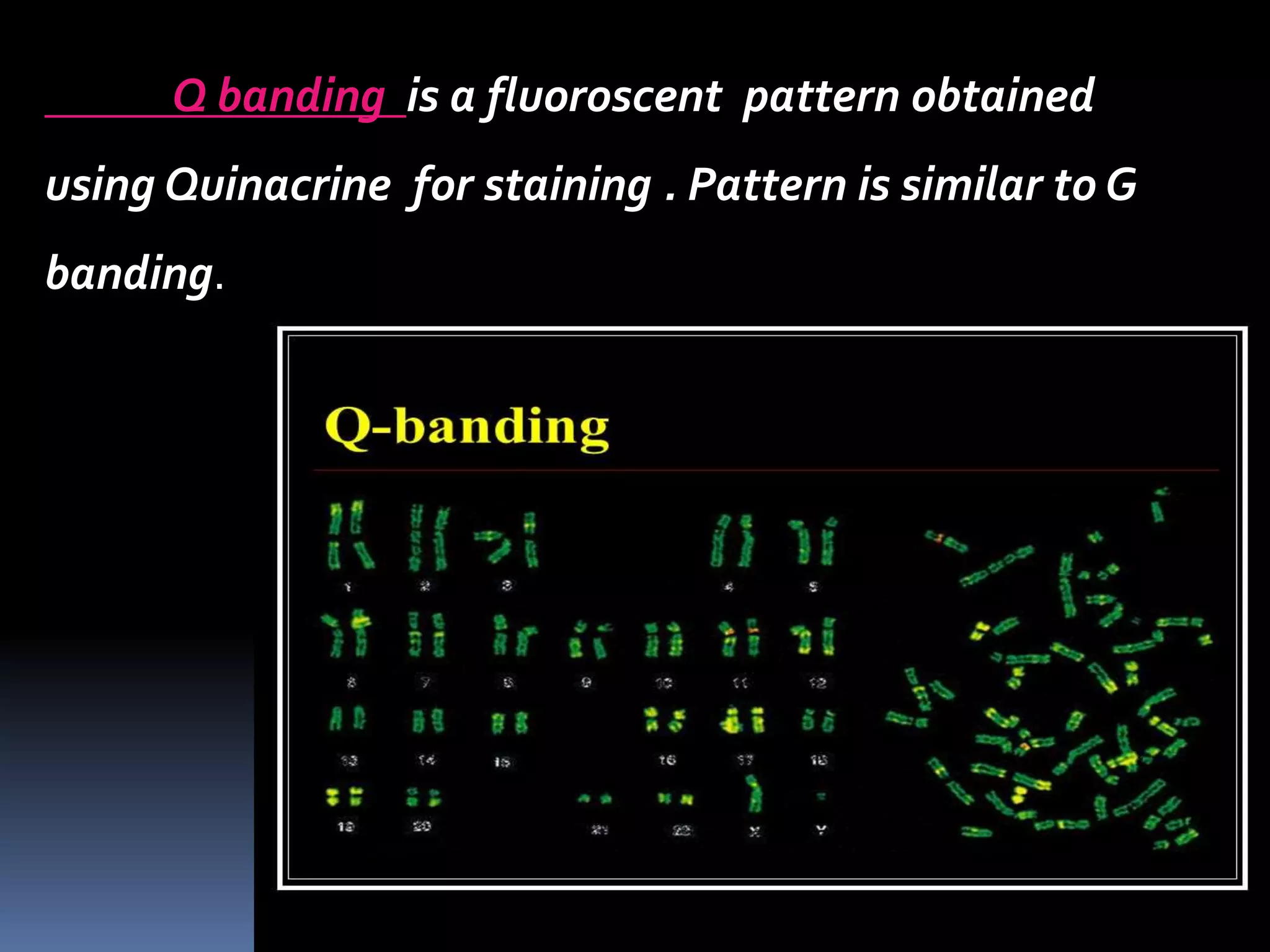 Q banding is a fluoroscent pattern obtained
using Quinacrine for staining . Pattern is similar to G
banding.
 
