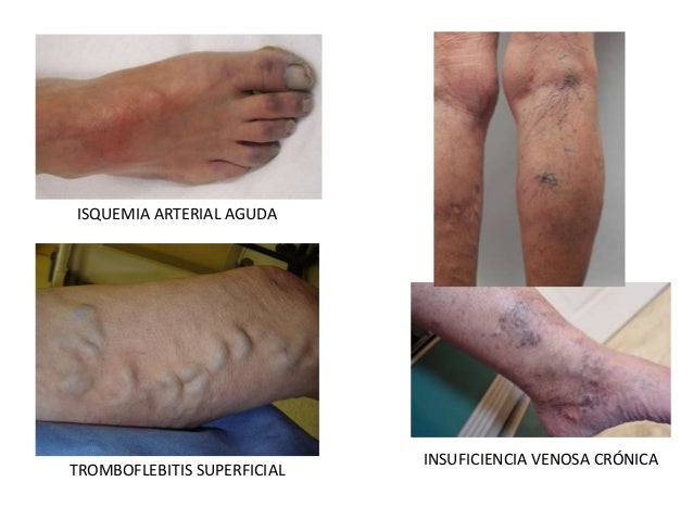 La cirugía vascular en habarovske los precios