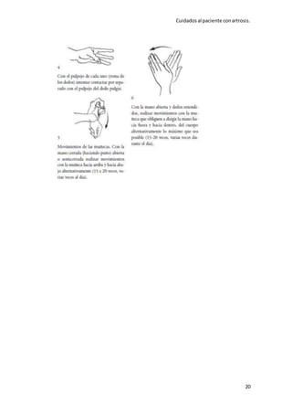 Cuidadosal paciente conartrosis.
20
 