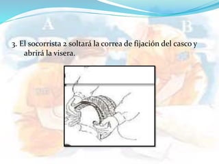 3. El socorrista 2 soltará la correa de fijación del casco y
abrirá la visera.
 