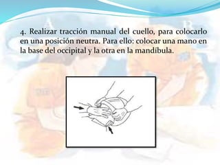 4. Realizar tracción manual del cuello, para colocarlo
en una posición neutra. Para ello: colocar una mano en
la base del occipital y la otra en la mandíbula.
 