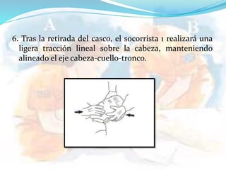 6. Tras la retirada del casco, el socorrista 1 realizará una
ligera tracción lineal sobre la cabeza, manteniendo
alineado el eje cabeza-cuello-tronco.
 