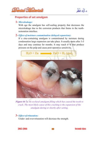 Microleakage:
With age the amalgam has self-sealing property that decreases the
microleakage due to the corrosion products that forms in the tooth-
restoration interface.
Effect of moisture contamination (delayed expansion):
If a zinc-containing amalgam is contaminated by moisture during
condensation large expansion can take place. It usually starts after 3-5
days and may continue for months. It may reach 4 % that produce
pressure on the pulp and cause post-operative sensitivity.
Figure (6-7): An occlusal amalgam filling which has caused the tooth to
crack. The most likely cause of this cracking is the expansion of the
amalgam during or shortly after setting.
Effect of trituration:
Under- and over-trituration will decrease the strength.
 
