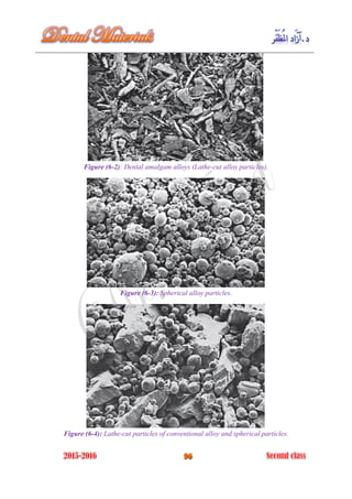 Figure (6-2): Dental amalgam alloys (Lathe-cut alloy particles).
Figure (6-3): Spherical alloy particles.
Figure (6-4): Lathe-cut particles of conventional alloy and spherical particles.
 