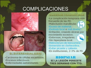 COMPLICACIONES
BIOPSIAR
SI LA LESIÓN PERSISTE
TRES SEMANAS CON TTO.
 