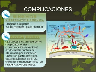 COMPLICACIONES
 