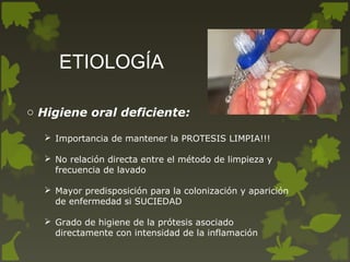 ETIOLOGÍA
o Higiene oral deficiente:
 Importancia de mantener la PROTESIS LIMPIA!!!
 No relación directa entre el método de limpieza y
frecuencia de lavado
 Mayor predisposición para la colonización y aparición
de enfermedad si SUCIEDAD
 Grado de higiene de la prótesis asociado
directamente con intensidad de la inflamación
 