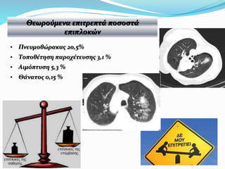• Πνευμοθώρακας 20,5%
• Τοποθέτηση παροχέτευσης 3,1 %
• Αιμόπτυση 5,3 %
• Θάνατος 0,15 %
Θεωρούμενα επιτρεπτά ποσοστά
επιπλοκών
 