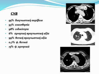 CNB
• 95% διαγνωστική ακρίβεια
• 93% ευαισθησία
• 98% ειδικότητα
• 6% αρνητική προγνωστική αξία
• 99% θετική προγνωστική αξία
• 0,7% ψ. θετικά
• 15% ψ. αρνητικά
 