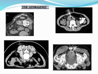 FNB ΛΕΝΦΑΔΕΝΕΣ
 