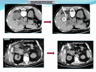 ΠΑΡΟΧΕΤΕΥΣΕΙΣ
 