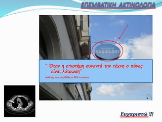 “ Όταν η επιστήμη συναντά την τέχνη ο πόνος
είναι λύτρωση”
Ασθενής που υπεβλήθη σε RFA πνεύμονα
Ευχαριστώ !!
 