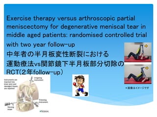 Exercise therapy versus arthroscopic partial
meniscectomy for degenerative meniscal tear in
middle aged patients: randomised controlled trial
with two year follow-up
中年者の半月板変性断裂における
運動療法vs関節鏡下半月板部分切除の
RCT(２年follow-up）
＊画像はイメージです
 