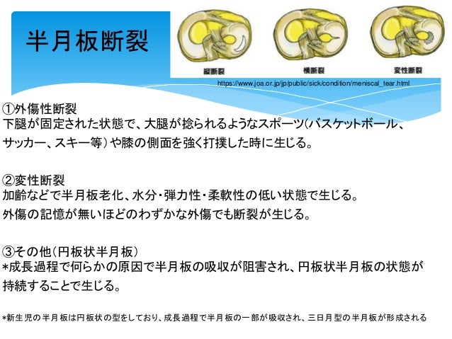 16 11 4 中年者の半月板変性断裂における運動療法vs関節鏡下半月板部分切除